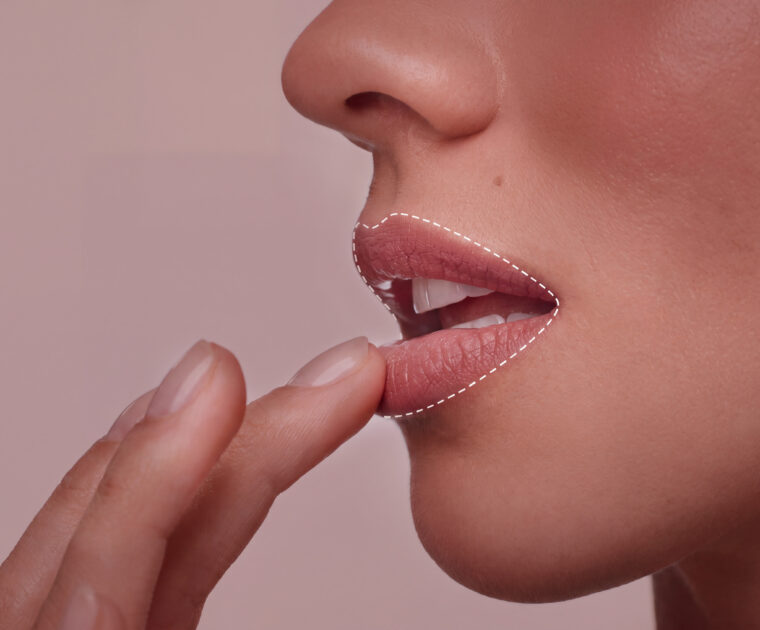 Close-up of a person touching the lower lip, outlined to indicate altered sensation