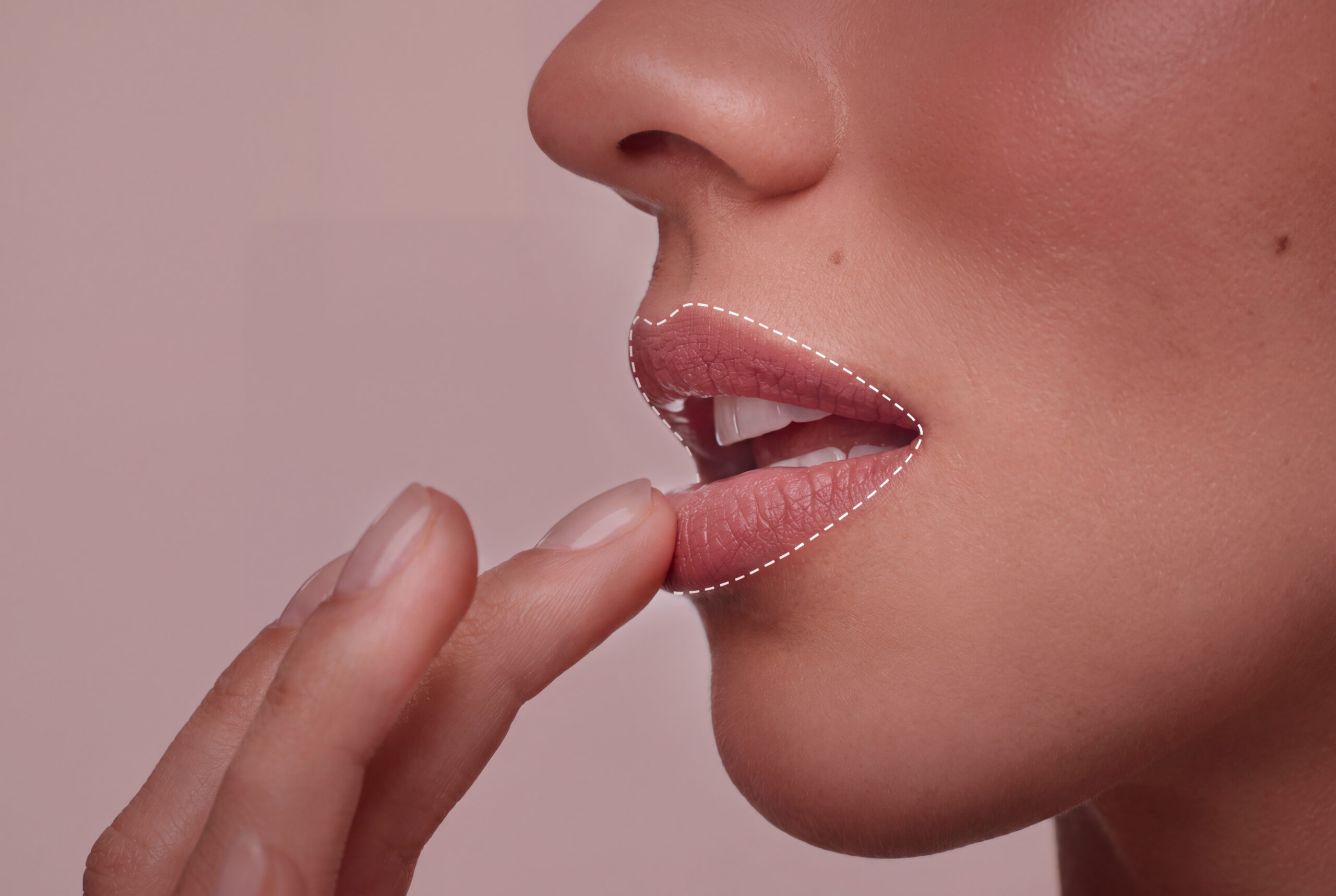 Close-up of a person touching the lower lip, outlined to indicate altered sensation
