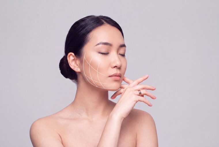 Woman with facial guide lines illustrating jaw alignment