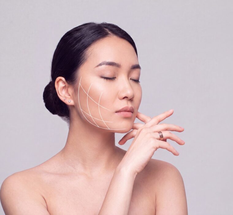 Woman with facial guide lines illustrating jaw alignment